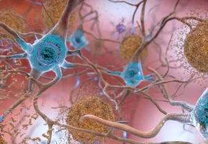 Аргинин против Альцгеймера: дешево, сердито и возможно работает