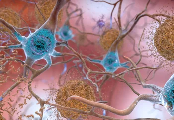 Аргинин против Альцгеймера: дешево, сердито и возможно работает