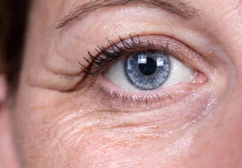 Зачем смотреть в паспорт, если под глазами всё написано?