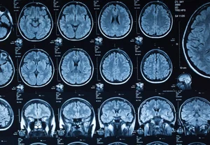 Пять фаз человеческого мозга: от катания в коляске до боя с пенсионкой