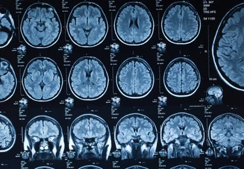 Пять фаз человеческого мозга: от катания в коляске до боя с пенсионкой