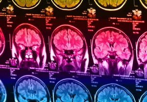 Смартфон как плацебо от одиночества: как наши мозги страдают без лайков и уведомлений