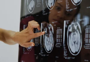 Толстый, но не глупый? Как лишний вес прямым курсом ведёт к сосудистой деменции