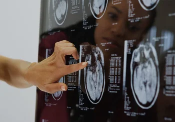 Толстый, но не глупый? Как лишний вес прямым курсом ведёт к сосудистой деменции