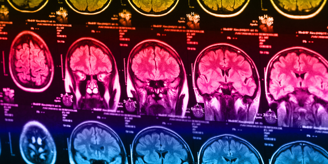 Смартфон как плацебо от одиночества: как наши мозги страдают без лайков и уведомлений